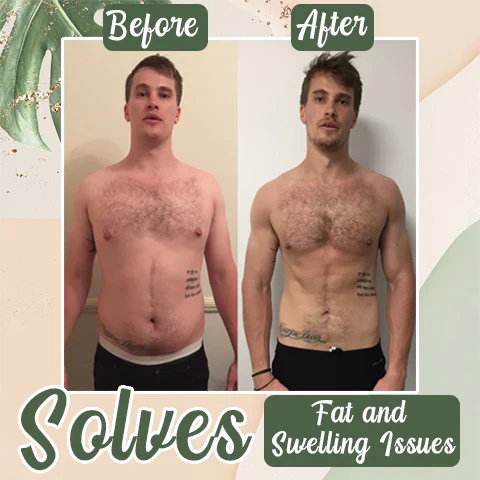 Perfect Detox Slimming Patch（Limited Time Discount 🔥 Last Day） - Image 5